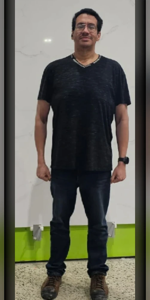 Antes e depois Emagrecedoras 2: Depois
